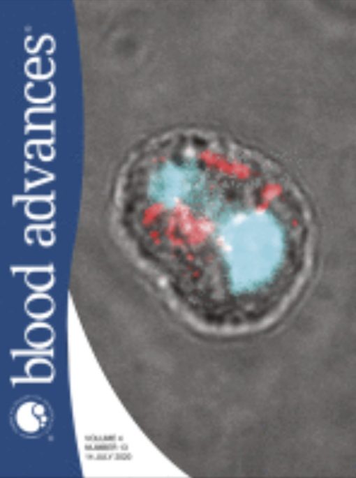 Blood Advances: Volume 4 (Issue 1 to Issue 24) 2020 PDF