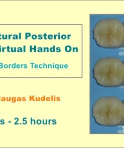 Fast Natural Posterior Fillings Virtual Hands On