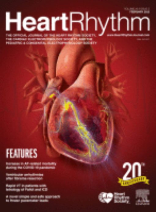 Heart Rhythm: Volume 20 (Issue 1 to Issue 12) 2023 PDF