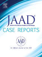 JAAD Case Reports: Volume 6 (Issue 1 to Issue 12) 2020 PDF