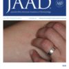 Journal of the American Academy of Dermatology: Volume 82 (Issue 1 to Issue 6) 2020 PDF