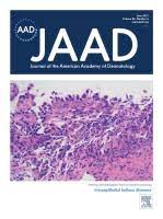 Journal of the American Academy of Dermatology: Volume 84 (Issue 1 to Issue 6) 2021 PDF