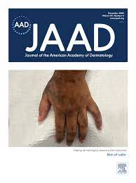 Journal of the American Academy of Dermatology: Volume 87 (Issue 1 to Issue 6) 2022 PDF