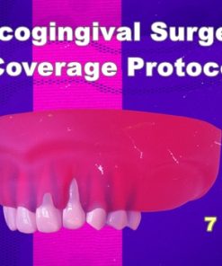 Mucogingival Surgery: Root Coverage Protocols 2.0