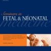 Seminars in Fetal and Neonatal Medicine: Volume 26 (Issue1 to Issue 6) 2021 PDF