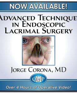 Advanced Techniques in Endoscopic Lacrimal Surgery