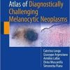 Atlas of Diagnostically Challenging Melanocytic Neoplasms 1st