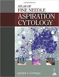 Atlas of Fine Needle Aspiration Cytology 1st Edition