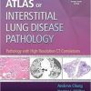 Atlas of Interstitial Lung Disease Pathology: Pathology with High Resolution CT Correlations 1 Har/Psc Edition