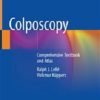 Colposcopy: Comprehensive Textbook and Atlas (EPUB)