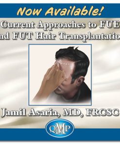 Current Approaches to FUE and FUT Hair Transplantation