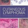 Cutaneous Lymphoma: Diagnosis and Treatment 1st Edition