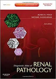 Diagnostic Atlas of Renal Pathology: Expert Consult – Online and Print, 2e