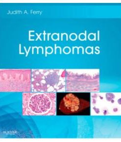 Extranodal Lymphomas: Expert Consult – Online and Print, 1e