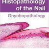 Histopathology of the Nail: Onychopathology 1st