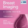 Breast Imaging (EPUB)
