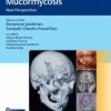 Invasive Skull Base Mucormycosis New Perspectives (PDF Book+Videos)