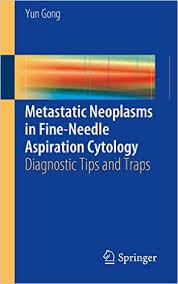 Metastatic Neoplasms in Fine-Needle Aspiration Cytology: Diagnostic Tips and Traps 1st ed. 2016 Edition