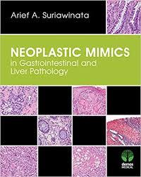 Neoplastic Mimics in Gastrointestinal and Liver Pathology (Pathology of Neoplastic Mimics) 1st Edition