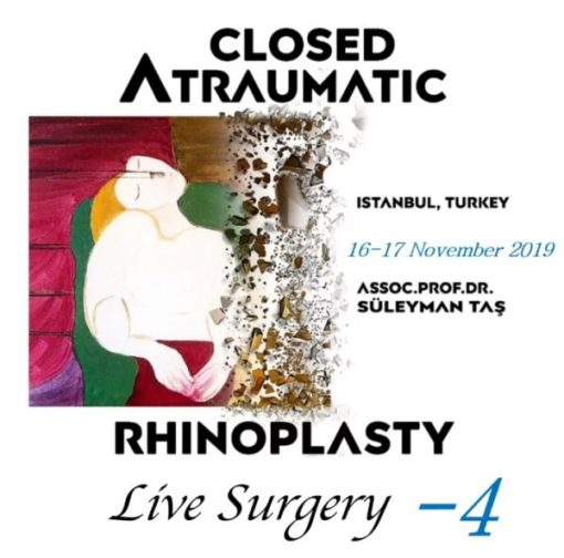 Closed Atraumatic Rhinoplasty Live Surgery DVD 4 / Digital