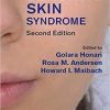 Sensitive Skin Syndrome, Second Edition 2nd
