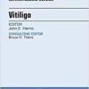 Vitiligo, An Issue of Dermatologic Clinics, 1e (The Clinics: Dermatology)