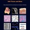 WHO Classification of Tumours of Soft Tissue and Bone (IARC WHO Classification of Tumours)-Original PDF