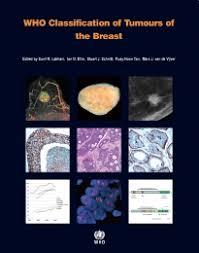 WHO Classification of Tumours of the Breast (IARC WHO Classification of Tumours)-Original PDF