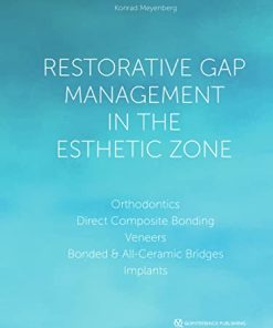 Restorative Gap Management in the Esthetic Zone: Orthodontics | Direct Composite Bonding | Veneers | Bonded & All-Ceramic Bridges | Implants (EPUB)