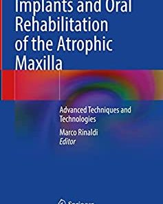 Implants and Oral Rehabilitation of the Atrophic Maxilla: Advanced Techniques and Technologies (EPUB)