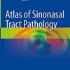 Atlas of Sinonasal Tract Pathology (PDF Book)