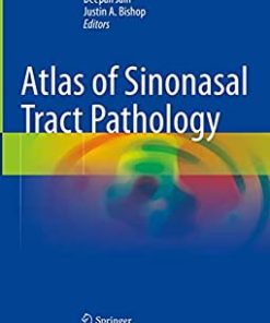Atlas of Sinonasal Tract Pathology (PDF Book)