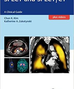 SPECT and SPECT/CT: A Clinical Guide (PDF)