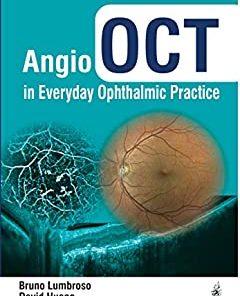 Angio OCT in Everyday Ophthalmic Practice (PDF)