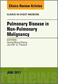 Pulmonary Complications of Non-Pulmonary Malignancy, An Issue of Clinics in Chest Medicine (Volume 38-2) (The Clinics: Internal Medicine, Volume 38-2) (PDF Book)