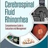 Cerebrospinal Fluid Rhinorrhea: Comprehensive Guide to Evaluation and Management (PDF)