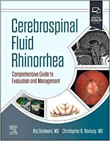 Cerebrospinal Fluid Rhinorrhea: Comprehensive Guide to Evaluation and Management (PDF)