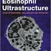 Eosinophil Ultrastructure: Atlas of Eosinophil Cell Biology and Pathology (PDF Book)