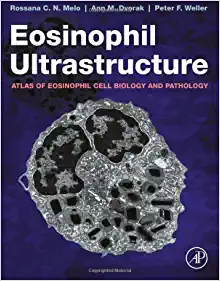 Eosinophil Ultrastructure: Atlas of Eosinophil Cell Biology and Pathology (PDF Book)
