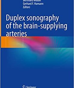 Duplex sonography of the brain-supplying arteries (EPUB)