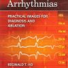 Electrophysiology of Arrhythmias: Practical Images for Diagnosis and Ablation (EPUB)