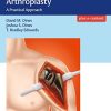 Reverse Shoulder Arthroplasty: A Practical Approach (PDF)
