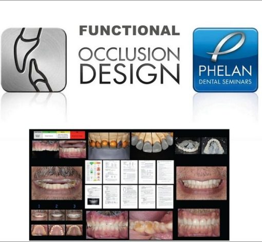 Functional Occlusion Design Dental Seminars (Full Bonus Package)