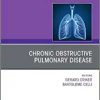 Chronic Obstructive Pulmonary Disease, An Issue of Clinics in Chest Medicine (Volume 41-3) (The Clinics: Internal Medicine, Volume 41-3) (PDF Book)