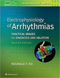 Electrophysiology of Arrhythmias: Practical Images for Diagnosis and Ablation, 2nd Edition (PDF Book)