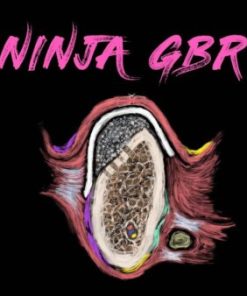 Implant Ninja GBR – Guided Bone Regeneration