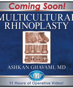 Multicultural Rhinoplasty: Techniques and Principles 2023