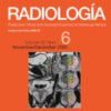 Radiología (English Edition): Volume 62 (Issue 1 to Issue 6) 2020 PDF