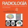 Radiología (English Edition): Volume 63 (Issue 1 to Issue 6) 2021 PDF