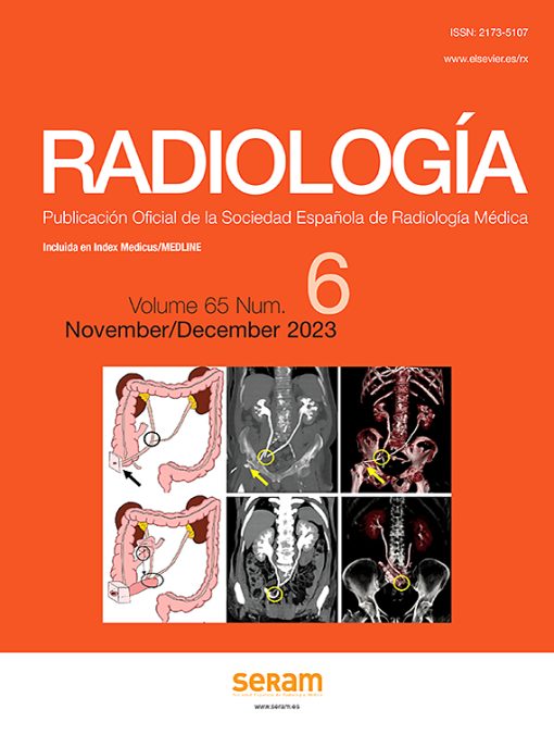 Radiología (English Edition): Volume 65 (Issue 1 to Issue 6) 2023 PDF
